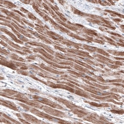 FCHSD2 Antibody, Novus Biologicals 0.1mL; Unlabeled:Antibodies, Polyclonal